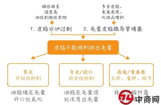 鼻子上的黑头是怎么形成的？教你该如何根除